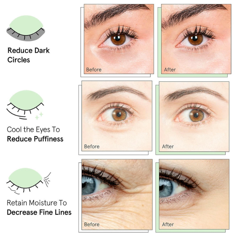 Collagen Eye Patches